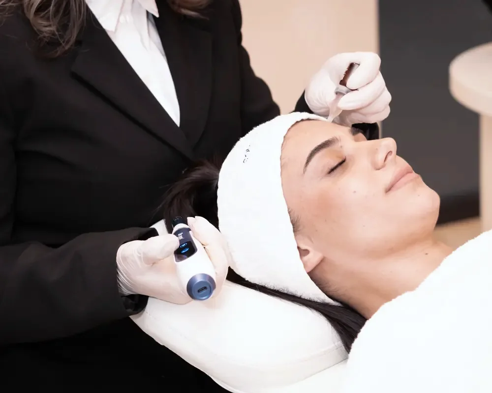 Dermapen bij Zina Beauty