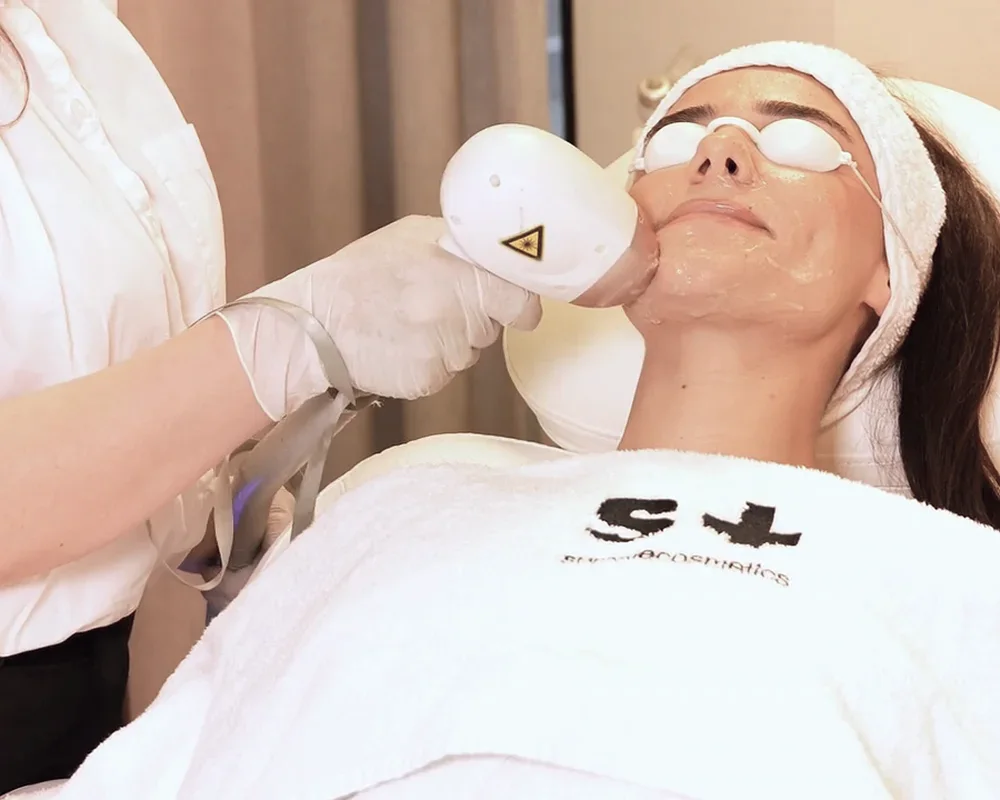 Laserontharing bij Zina Beauty